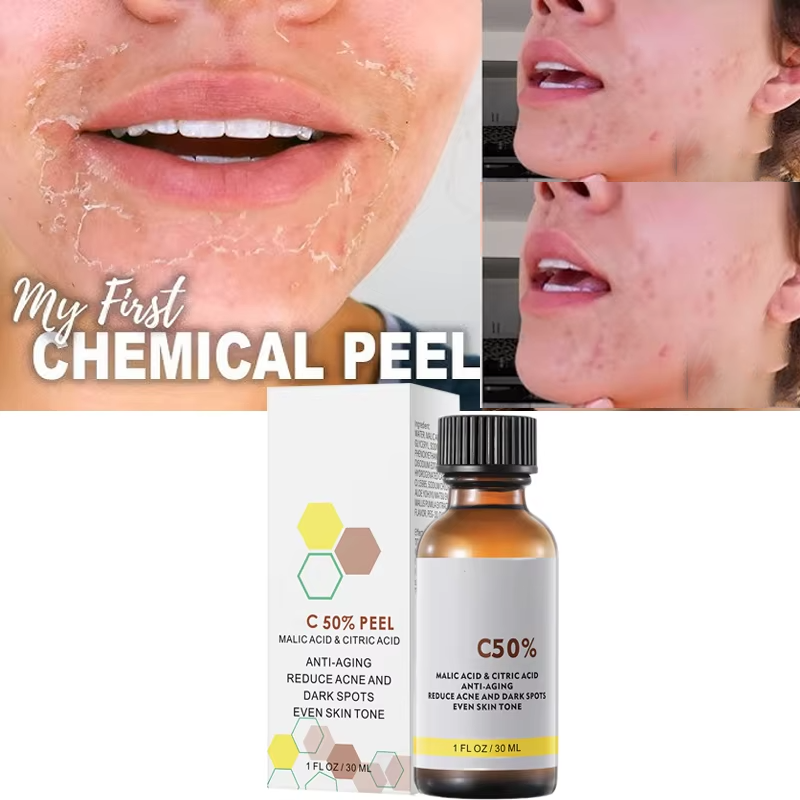 Licorice Root Extract - Yüz Yüz Peelingi İçin Malik Asit