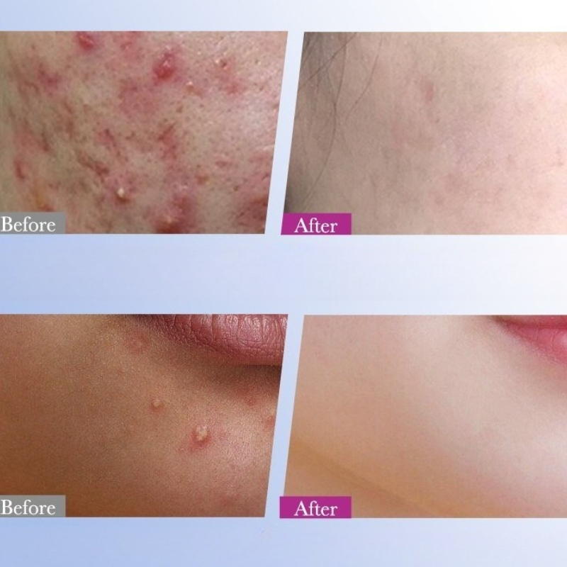 7/10/14 adet renkli yıldız siv - Skincare Qv incelemesi ve fiyatı