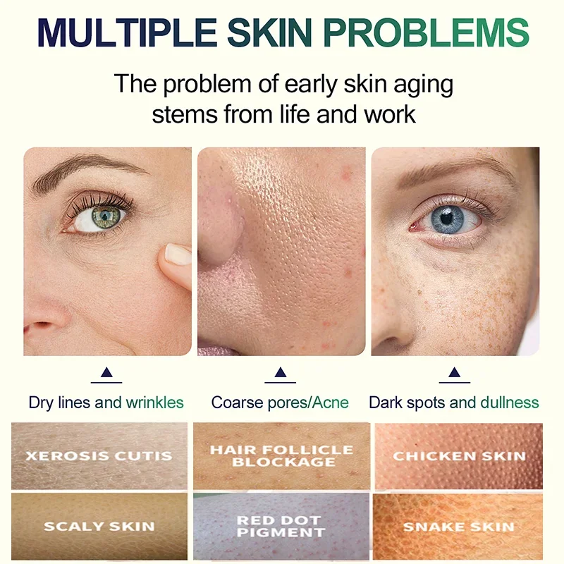 2. Nesil Salisilik Asit Yüz Pe - Salicylic Acid Cleanser incelemesi ve fiyatı