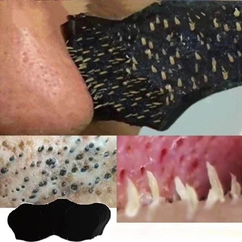 10PC/50 PC100 PC Siyah Nokta B - Skincare Viral Tiktok incelemesi ve fiyatı