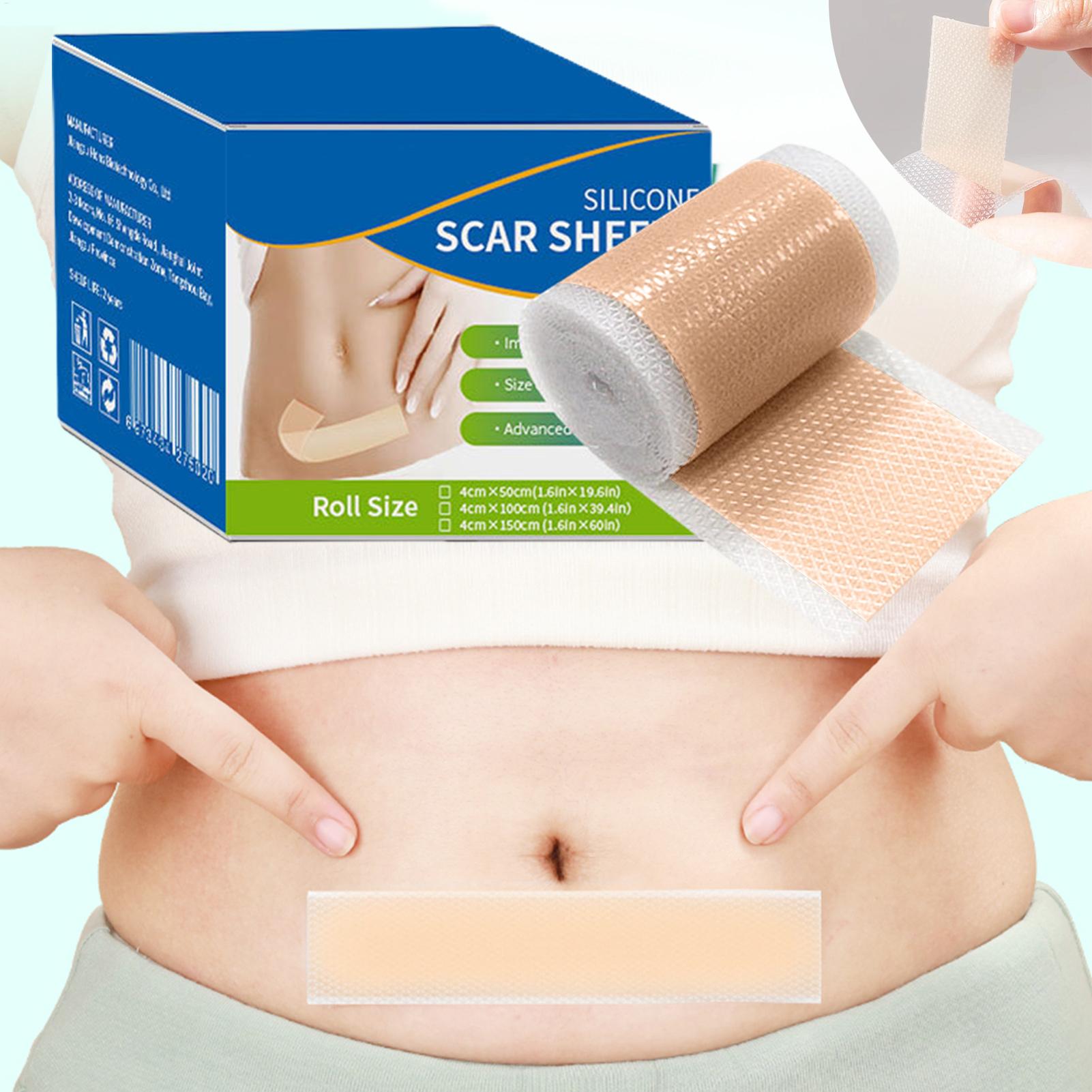 1 Rulo Silikon Skar Bandı 4cmX - Skincare Collagen incelemesi ve fiyatı